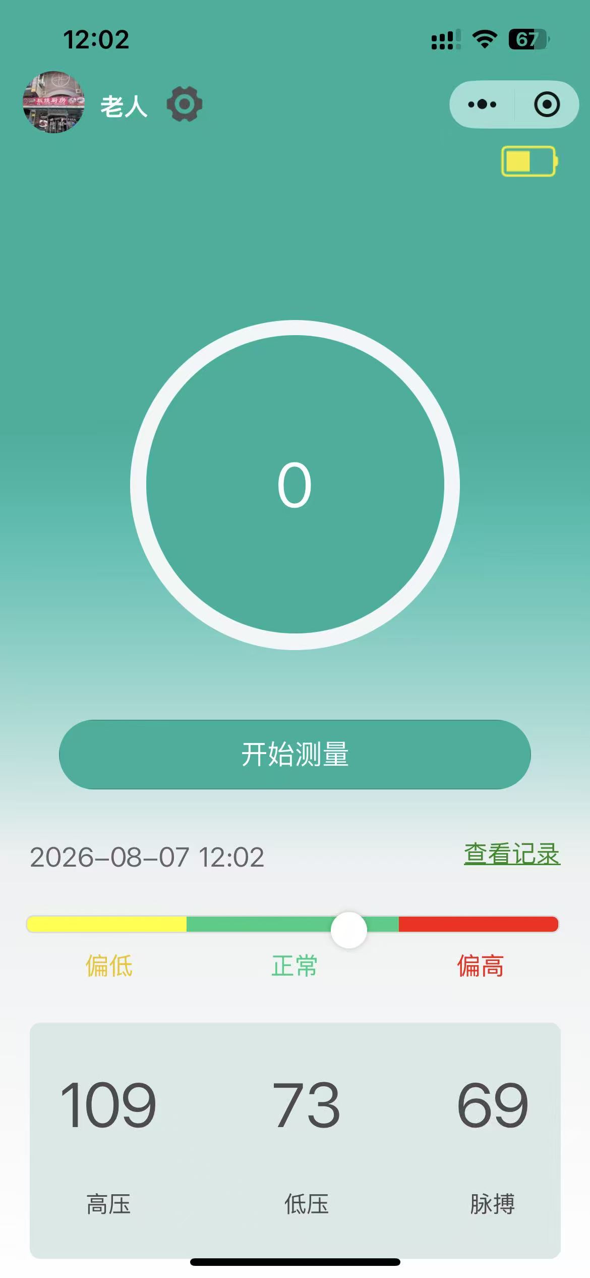 蓝牙血压计微信小程序测量界面